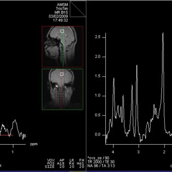 1H spectra, C. Boesch, Bern, CH