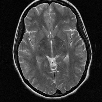 1H anatomical, C. Boesch, Bern, CH