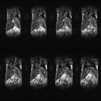 liver_8slice_3mins