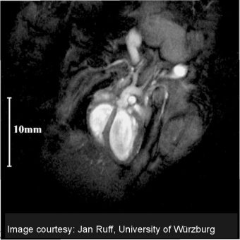 Mouse Heart Image @ 3 T