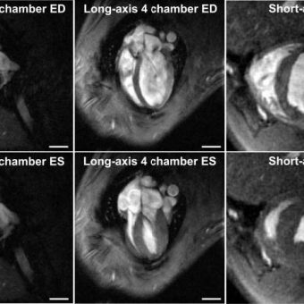 rat heart images at 9.4 T