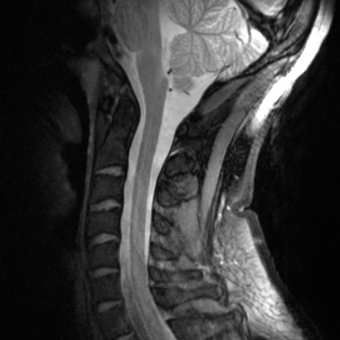 NMR-Picture_Cervical Spine Array 7 T