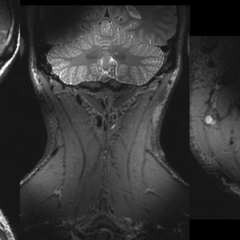NMR-Picture_Cervical Spine Array 7 T
