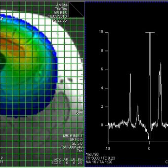 NMR-Picture_Dual Tuned Flex Surface Coils M_L 3T