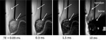 NMR-Picture_Small Animal Surface Coils